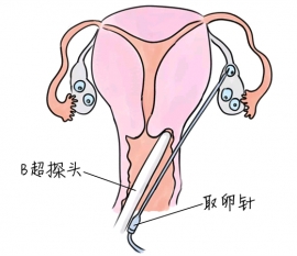 幼儿学画画，天津捐卵宝宝学画画，学画画的好处，如何学画画