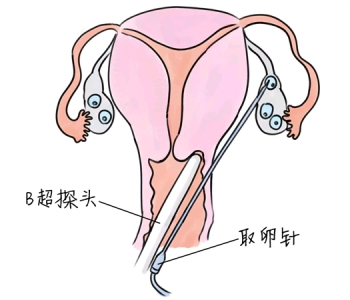 幼儿学画画，天津捐卵宝宝学画画，学画画的好处，如何学画画